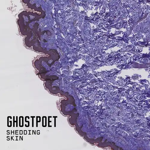 Shedding Skin Exclusive Offer