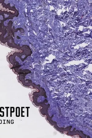 Ghostpoet - Shedding Skin (LP) Money Back Guarantee